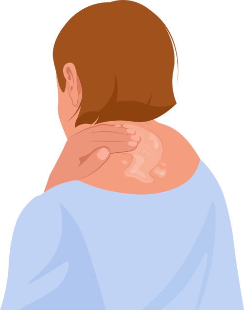 Step By Step Guide: How can you Permanently Relieve Cervical Pain